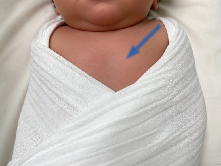 Should Newborns Be Swaddled to Sleep? Understanding the Risks