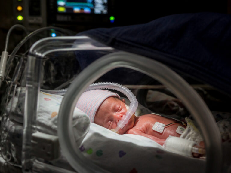 The Truth Revealed: Do Preemie Babies Actually Sleep More?